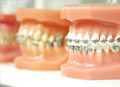 Orthodontics