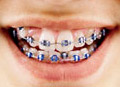 Orthodontics