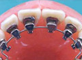 Orthodontics